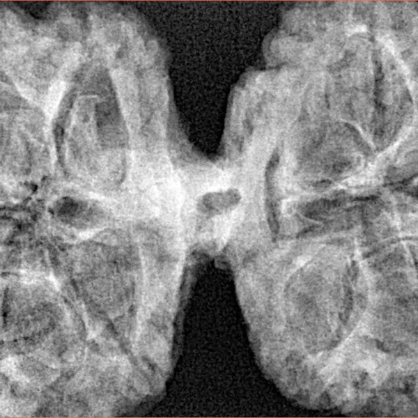 10 Mk Gaurishankar 43.4mm 9.48gm - Xray