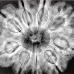 9 Mukhi Rudraksha 31.6mm 8gm - Xray