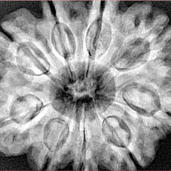 9 Mukhi Rudraksha 31.6mm 8gm - Xray