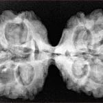 11 MK Gaurishankar 37.6mm 7.6gm - Xray