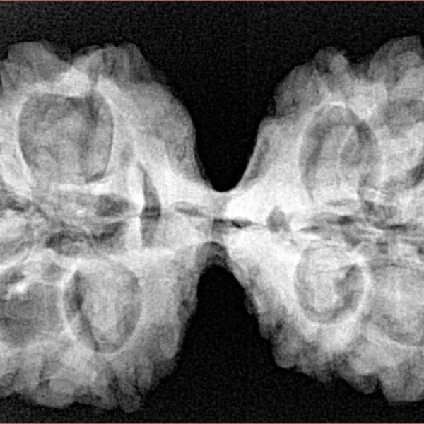 11 MK Gaurishankar 37.6mm 7.6gm - Xray