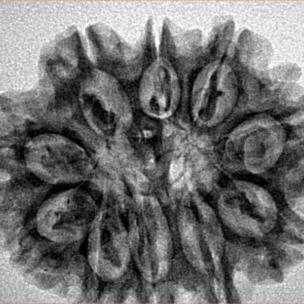 10 Mukhi Rudraksha 29.2mm 5.07gm - Xray