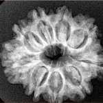 9 Mukhi Rudraksha 26.2mm 4.29gm - Xray