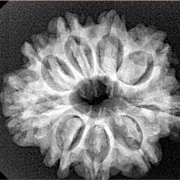 9 Mukhi Rudraksha 26.2mm 4.29gm - Xray