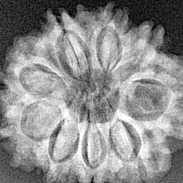 9 Mukhi Rudraksha 25.9mm 4.21gm - Xray