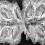 12 MK Gaurishankar 40.9mm 10.08gm - Xray