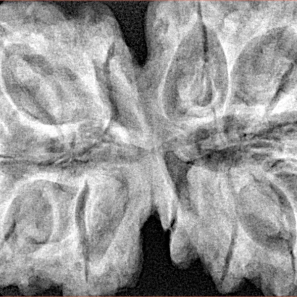 12 MK Gaurishankar 40.9mm 10.08gm - Xray