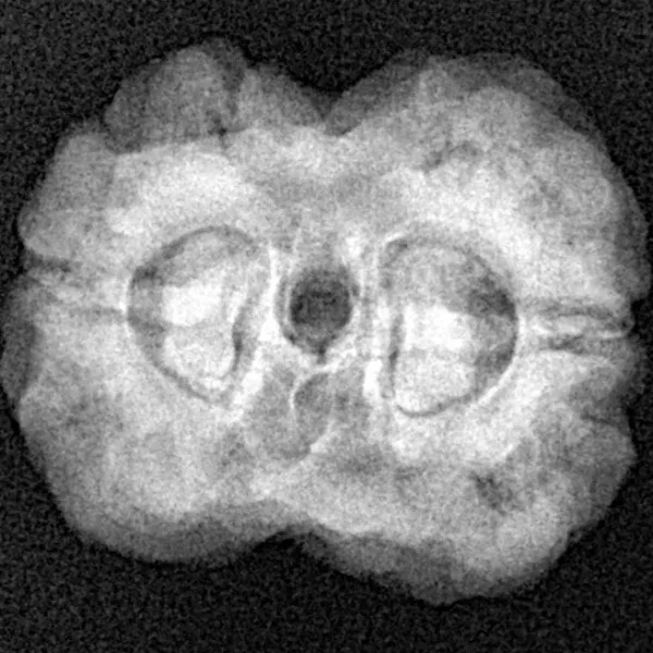 2 Mukhi Rudraksha 24mm 3.52gm - Xray