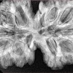 13 MK Gaurishankar 40.7mm 8.78gm - Xray
