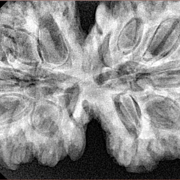 13 MK Gaurishankar 40.7mm 8.78gm - Xray