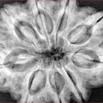 9 Mukhi Rudraksha 31.7mm 8.89gm - Xray