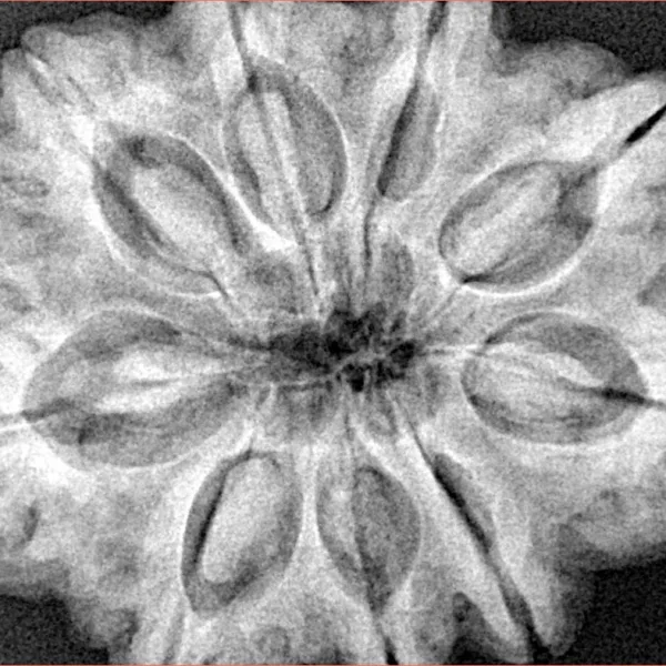 9 Mukhi Rudraksha 31.7mm 8.89gm - Xray