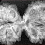 12 MK Gaurishankar 42mm 8.21gm - Xray