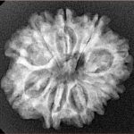 10 Mukhi Rudraksha 25.3mm 3.69gm - Xray