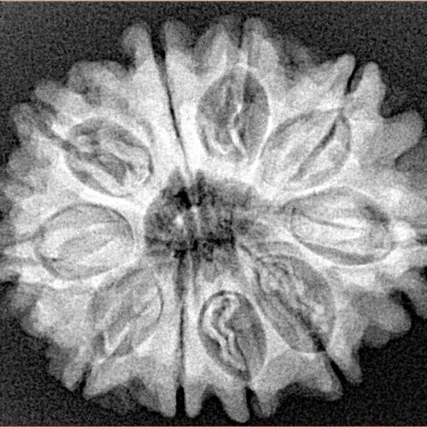 10 Mukhi Rudraksha 28.4mm 5.17gm - Xray