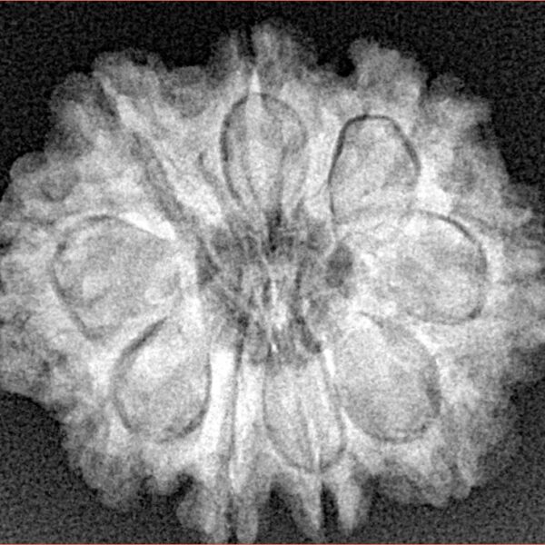9 Mukhi Rudraksha 25.2mm 4.46gm - Xray