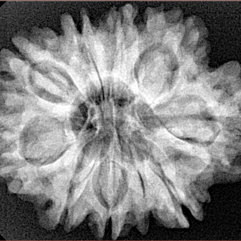 9 Mukhi Rudraksha 29.1mm 5.63gm - Xray