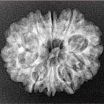 10 Mukhi Rudraksha 25mm 3.18gm - Xray