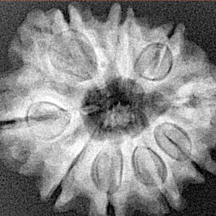 9 Mukhi Rudraksha 25.5mm 4.33gm - Xray