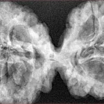 9 MK Gaurishankar 44.6mm 7.84gm - Xray