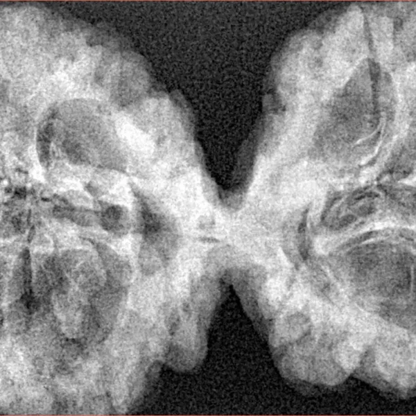 9 MK Gaurishankar 44.6mm 7.84gm - Xray