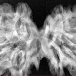 12 MK Gaurishankar 39.6mm 7.17gm - Xray