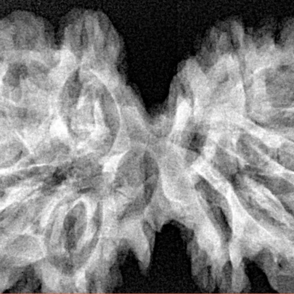 12 MK Gaurishankar 39.6mm 7.17gm - Xray