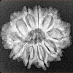 10 Mukhi Rudraksha 24.9mm 3.76gm - Xray