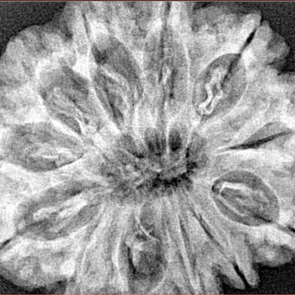 12 Mukhi Rudraksha 33.4mm 7.6gm - Xray