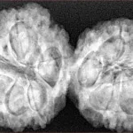 9 MK Gaurishankar 38.8mm 8.31gm - Xray