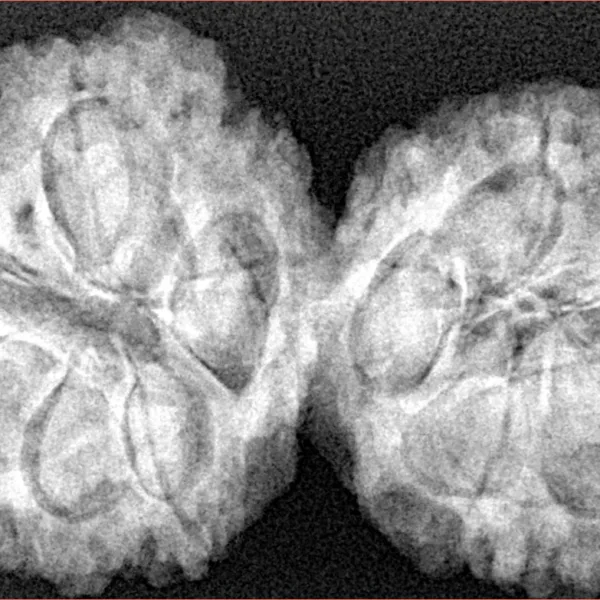 9 MK Gaurishankar 38.8mm 8.31gm - Xray