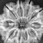 10 Mukhi Rudraksha 30.1mm 6.24gm - Xray