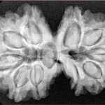 10 Mk Gaurishankar 35.2mm 7gm - Xray