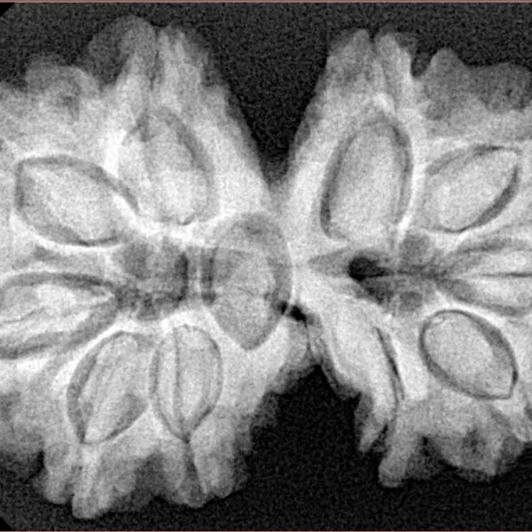 10 Mk Gaurishankar 35.2mm 7gm - Xray