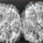 10 Mk Gaurishankar 41mm 6.56gm - Xray