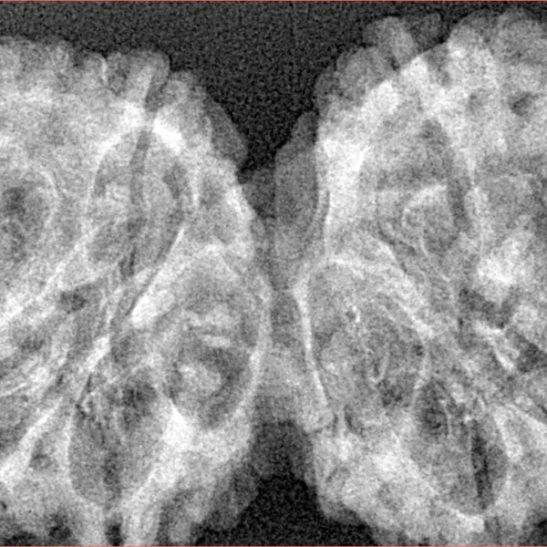 10 Mk Gaurishankar 41mm 6.56gm - Xray
