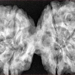 9 MK Gaurishankar 42.6mm 10gm - Xray