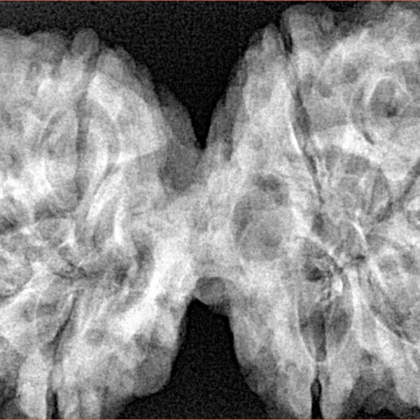 9 MK Gaurishankar 42.6mm 10gm - Xray