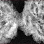 9 MK Gaurishankar 46mm 10.67gm - Xray