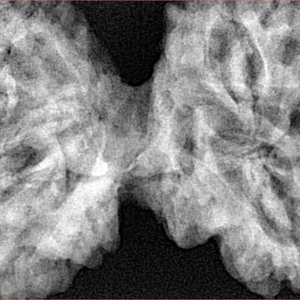 9 MK Gaurishankar 46mm 10.67gm - Xray