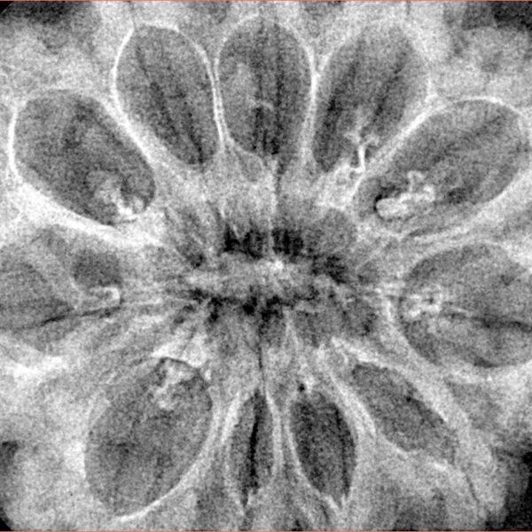 11 Mukhi Rudraksha 35.4mm 6.85gm - Xray