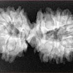 17 MK Gaurishankar 35.9mm 6.06gm - Xray