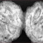 9 MK Gaurishankar 43.7mm 12.5gm - Xray