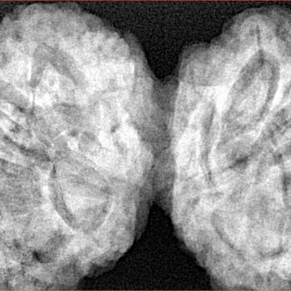 9 MK Gaurishankar 43.7mm 12.5gm - Xray