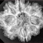 9 Mukhi Rudraksha 28.9mm 5.38gm - Xray