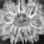 9 Mukhi Rudraksha 31.7mm 6.11gm - Xray
