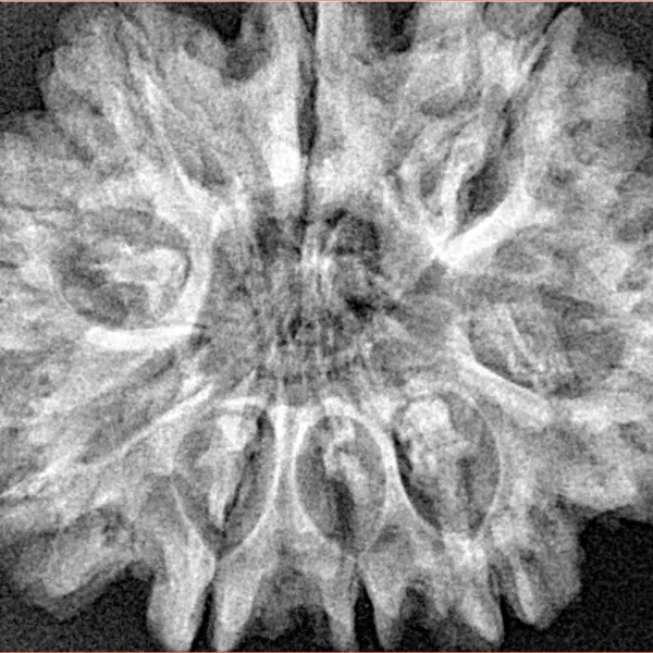 9 Mukhi Rudraksha 31.7mm 6.11gm - Xray
