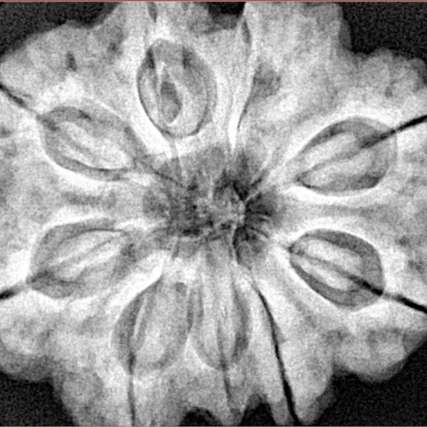 9 Mukhi Rudraksha 30.3mm 9.42gm - Xray