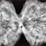 10 Mk Gaurishankar 43mm 11.33gm - Xray