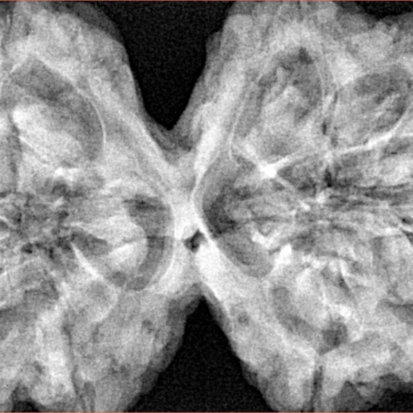 10 Mk Gaurishankar 43mm 11.33gm - Xray